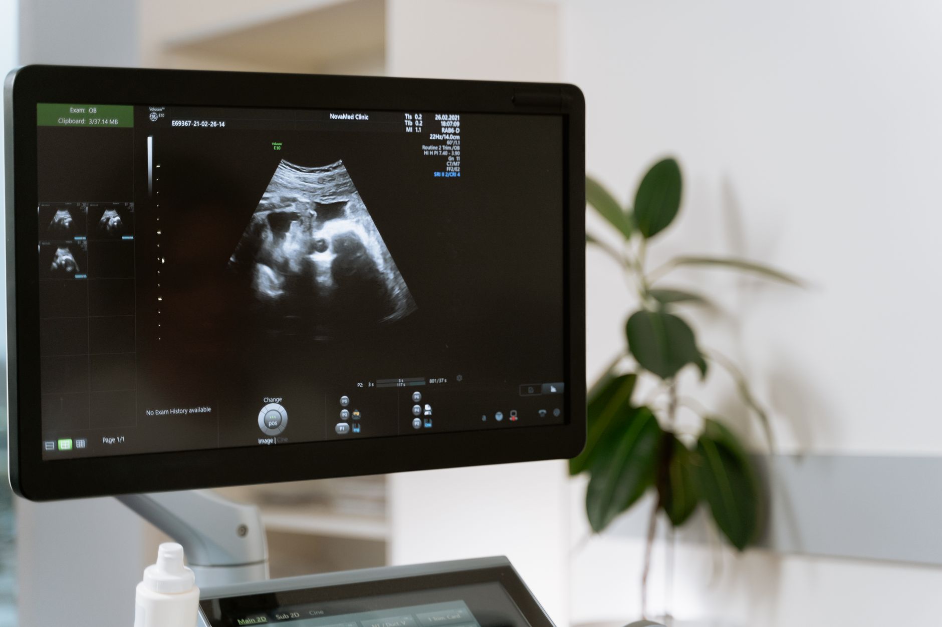 16-week ultrasound image