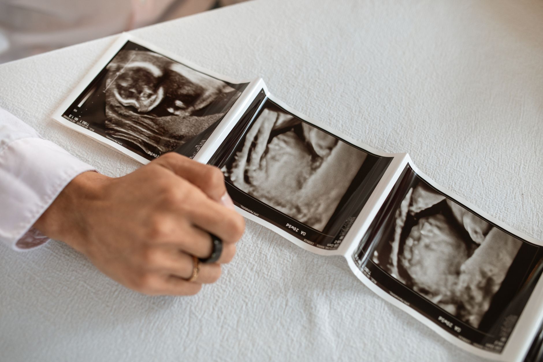 hands holding a birth plan checklist next to a stethoscope and a prenatal ultrasound printout, illustrating thoughtful delivery planning for older mothers