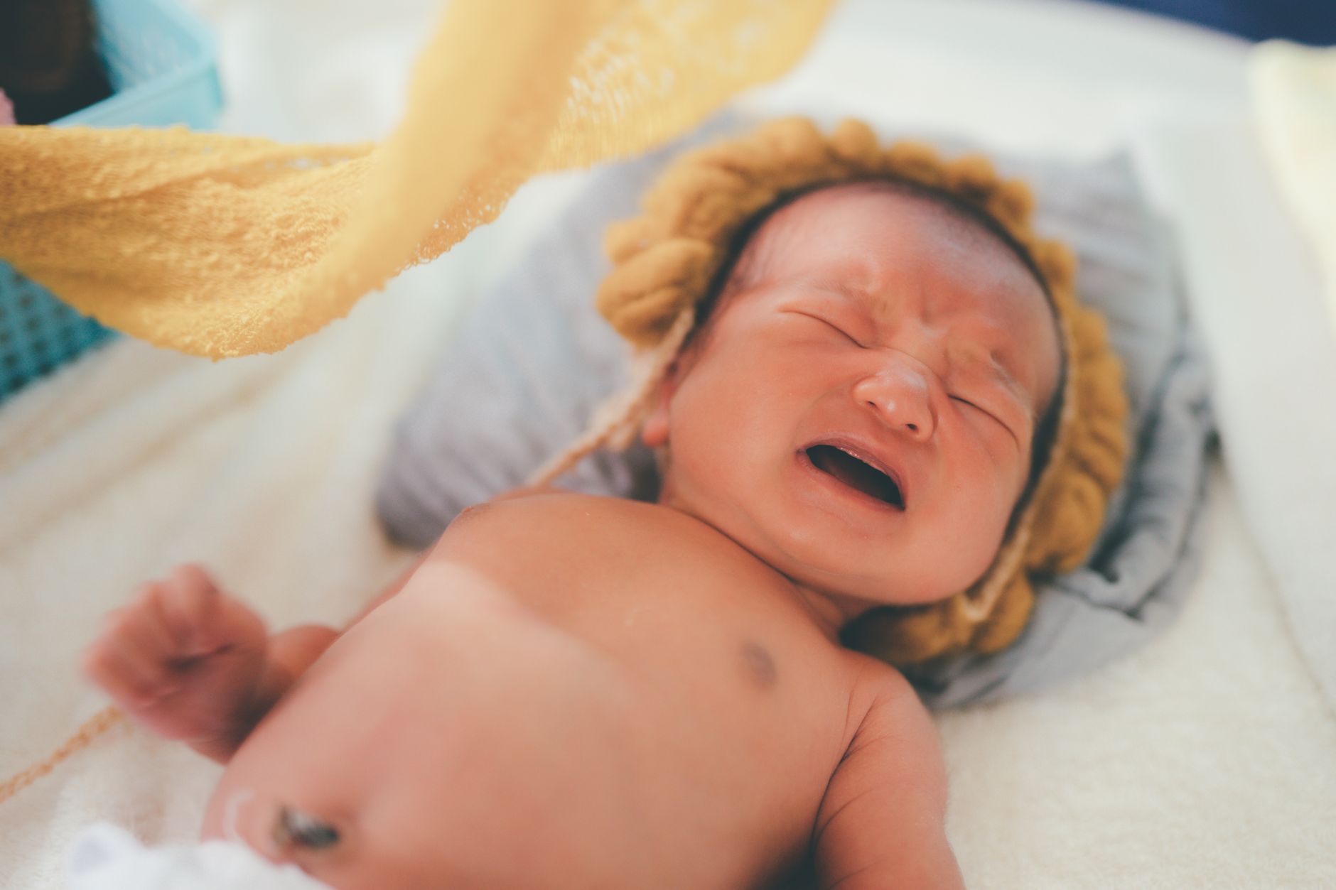 Newborn eye with yellow discharge