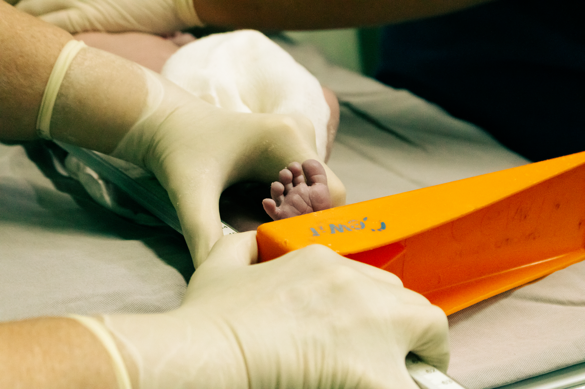 Baby's gestational age: Interpreting the New Ballard Score Results
