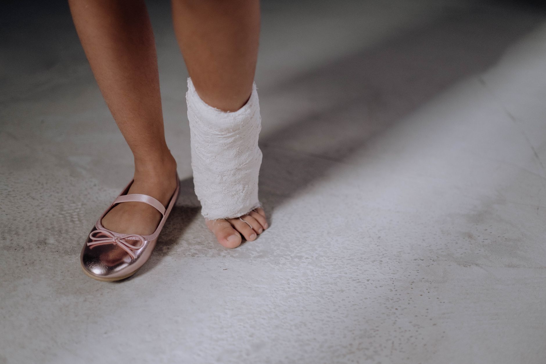 Baby's foot in a white plaster Ponseti cast.