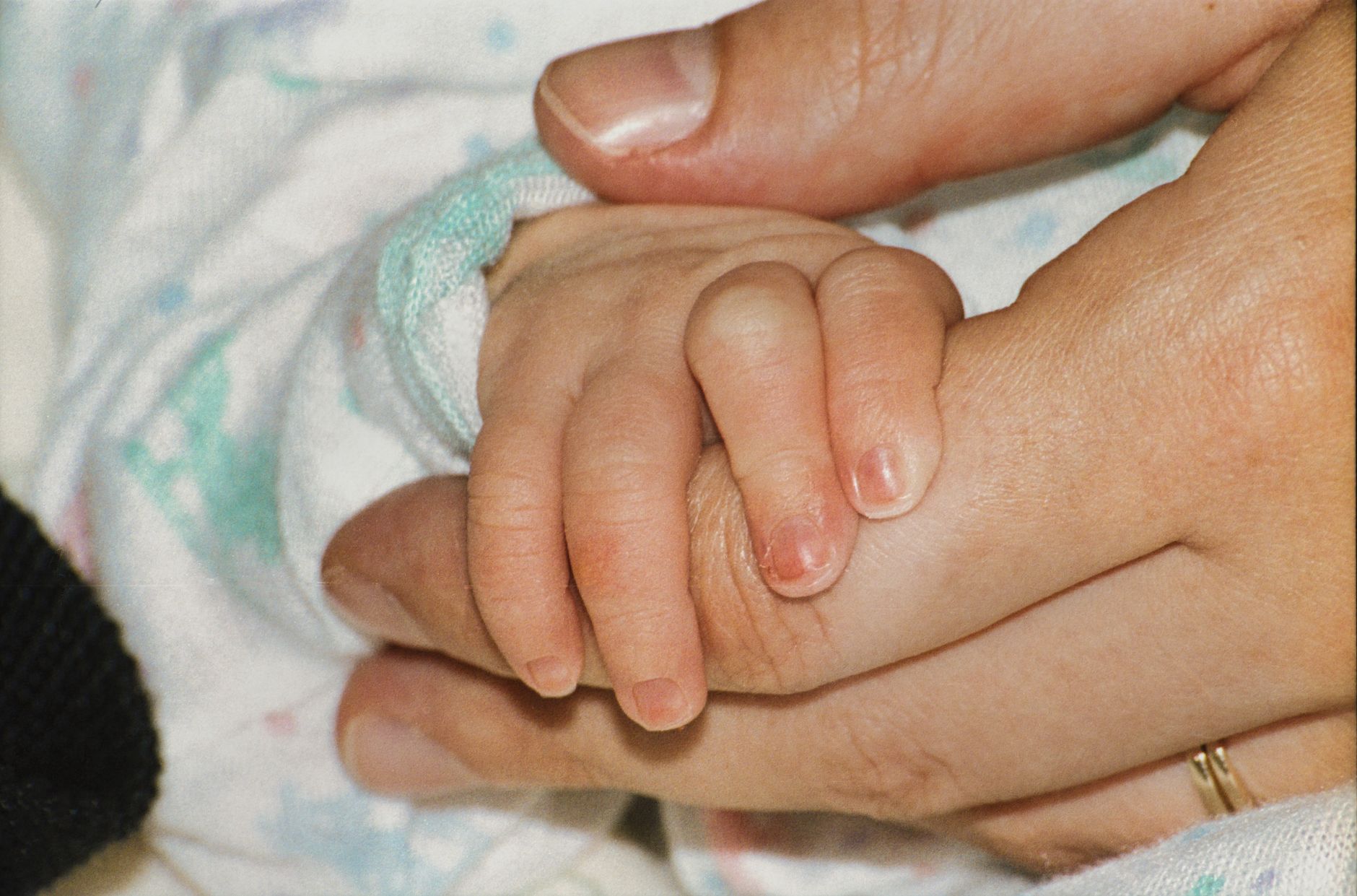 A parent gently holding their baby's leg, checking for redness or swelling after a vaccine shot