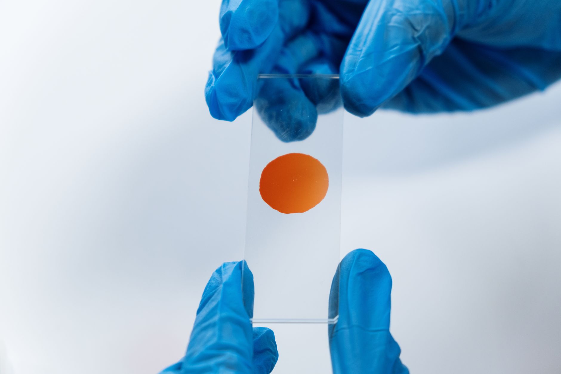 Close‑up of a genetics laboratory technician examining a slide of cultured chorionic villi under a microscope, with soft lighting and a calm workspace