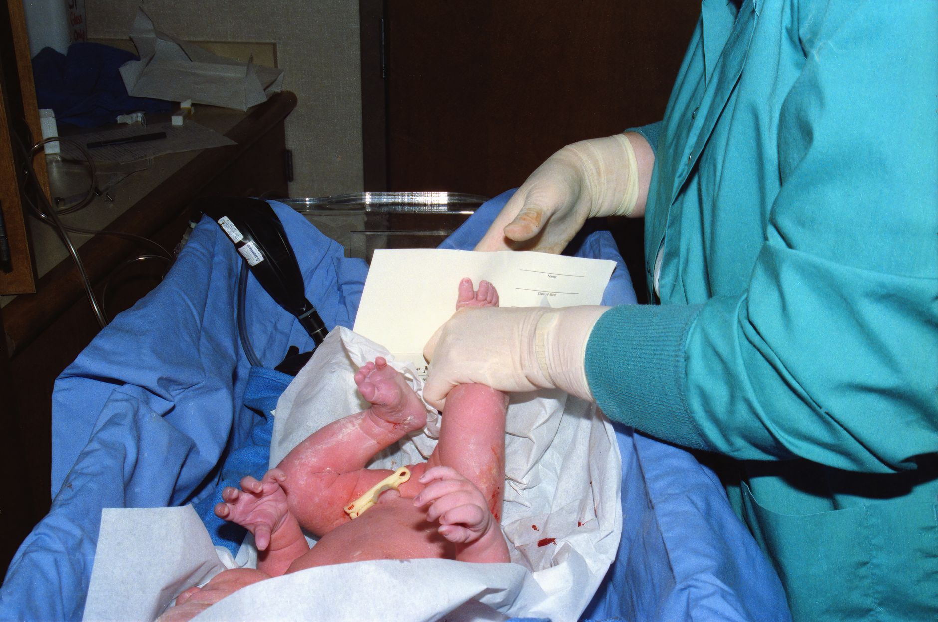 Delayed Cord Clamping Benefits: Why It Matters for Newborn Health