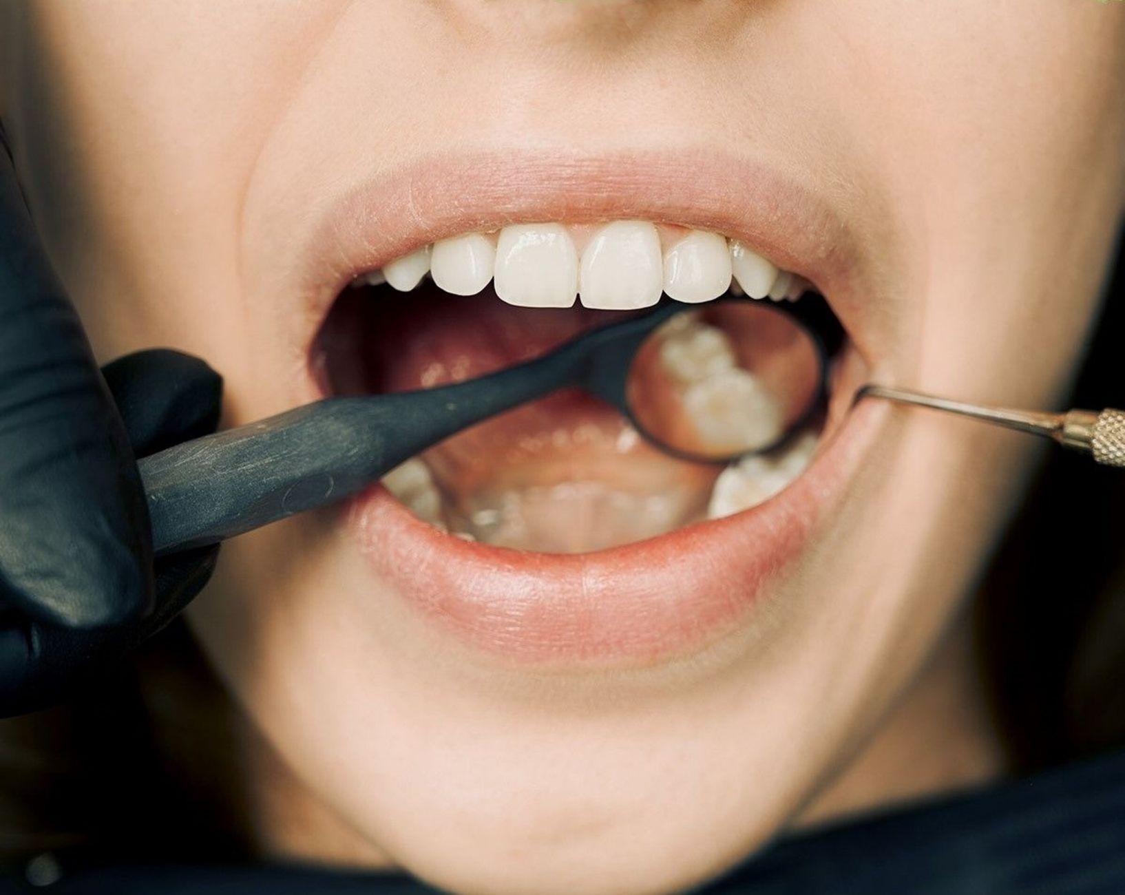 A pediatric dentist gently examining a baby's gums with a soft probe, soft natural light, clean clinic setting
