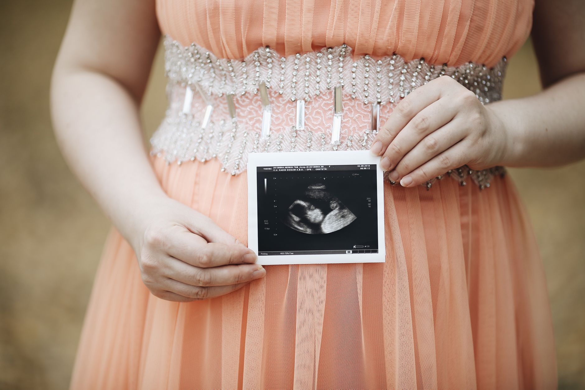 Pregnant woman holding a prenatal ultrasound printout, smiling with relief after seeing reassuring Doppler results