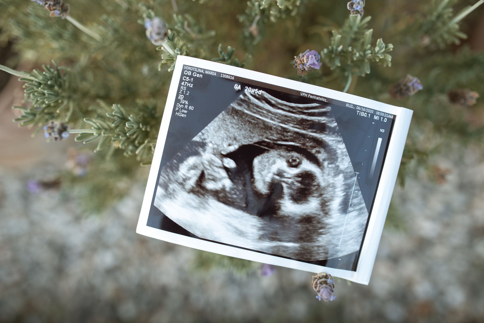 Diagram of a first-trimester ultrasound showing labeled structures: gestational sac, yolk sac, embryo, crown-rump length