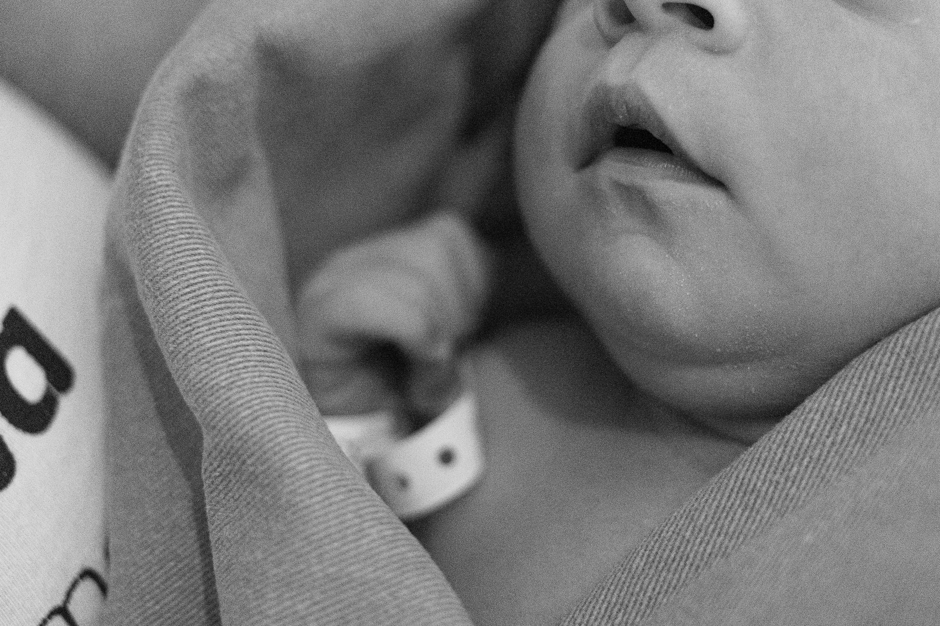 Gentle swaddle for rash