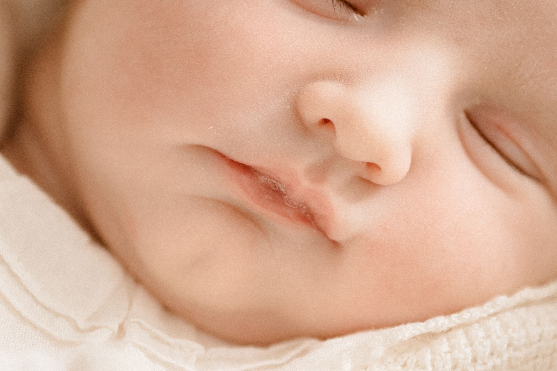 How to treat oral thrush in breastfed baby: safe home remedies