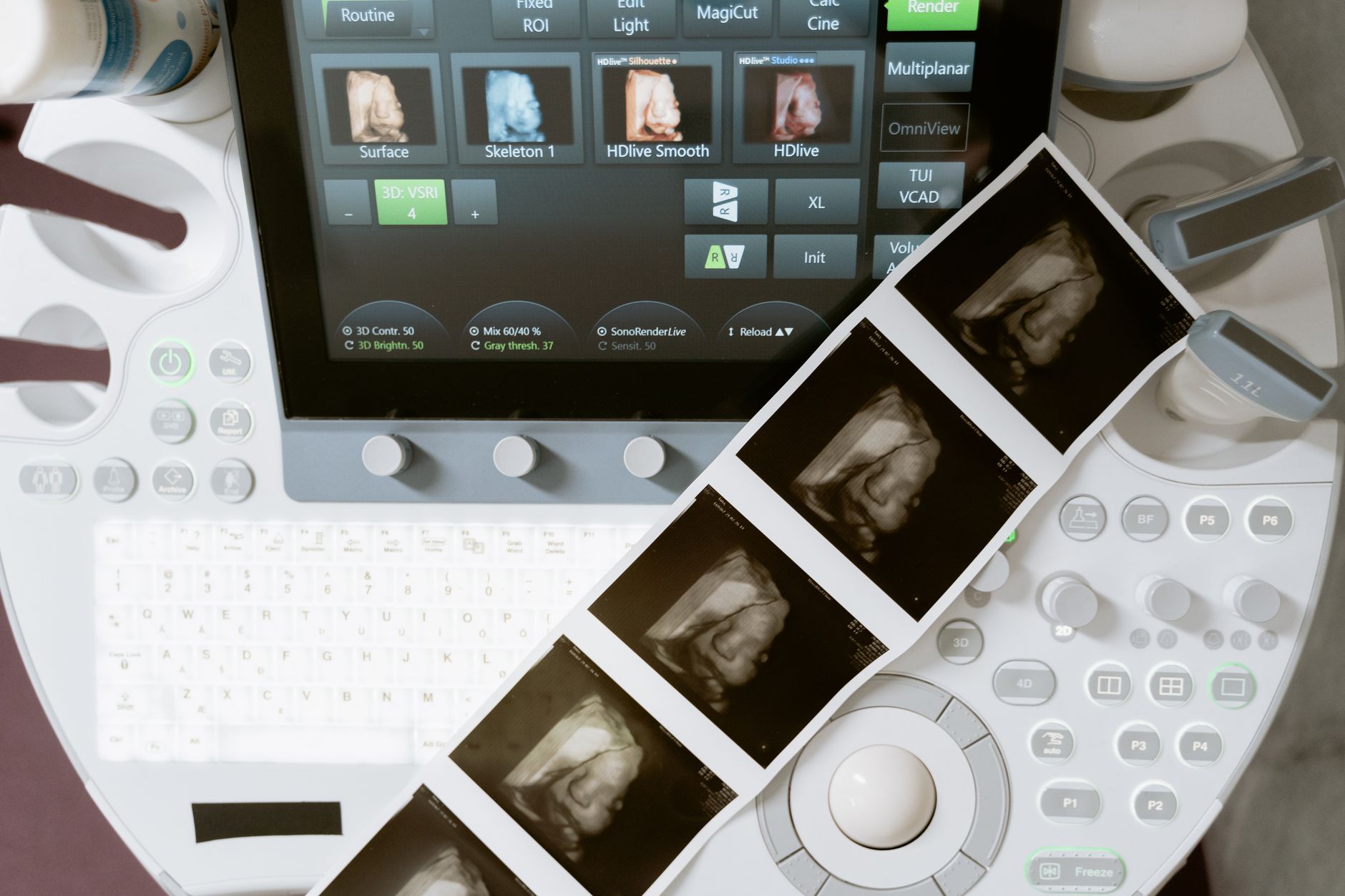 A prenatal care setting with a bottle of vitamin supplements, a stethoscope, and a pregnancy ultrasound image on a screen, illustrating safe supplement choices