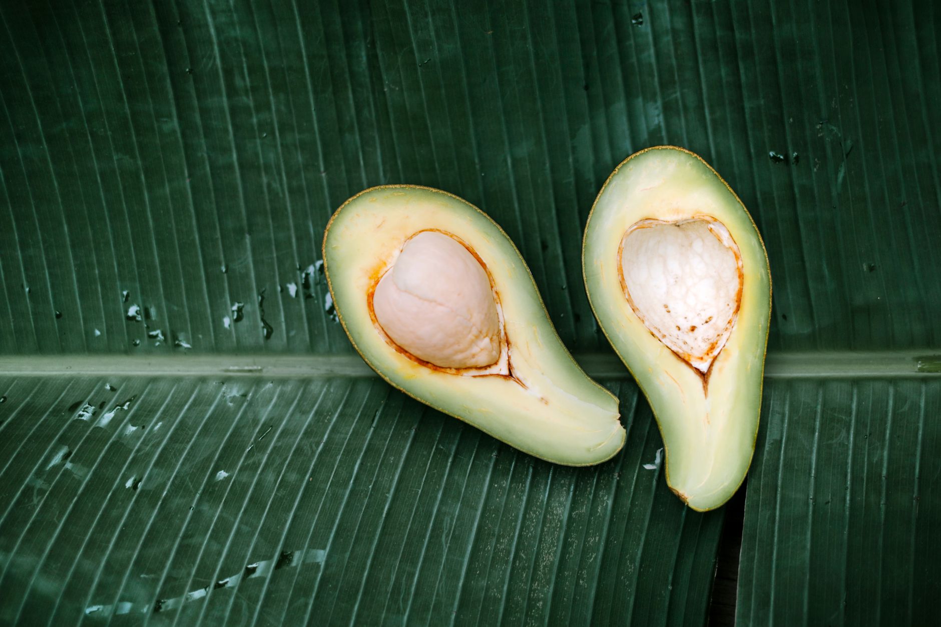 close‑up of a prenatal vitamin bottle beside fresh bananas and avocado halves, showing natural magnesium‑rich foods alongside a supplement