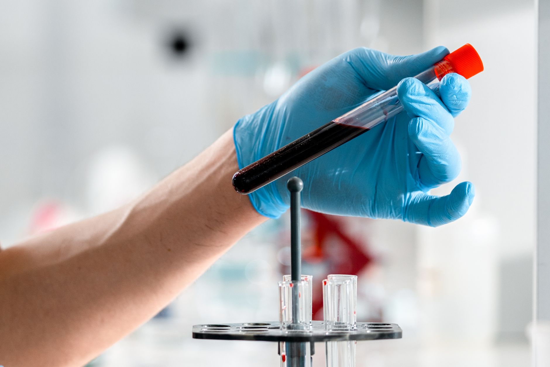 Laboratory technician holding a test tube of serum, bright clinical lighting, modern lab equipment in background