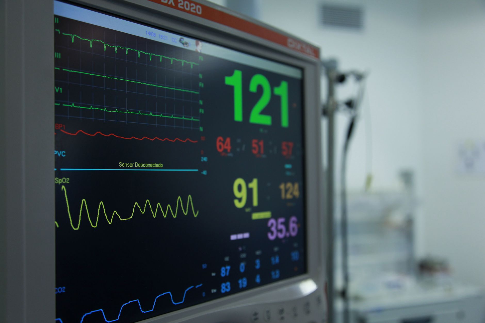 Digital NICU monitor showing a newborn's core temperature at 33.5°C during therapeutic hypothermia