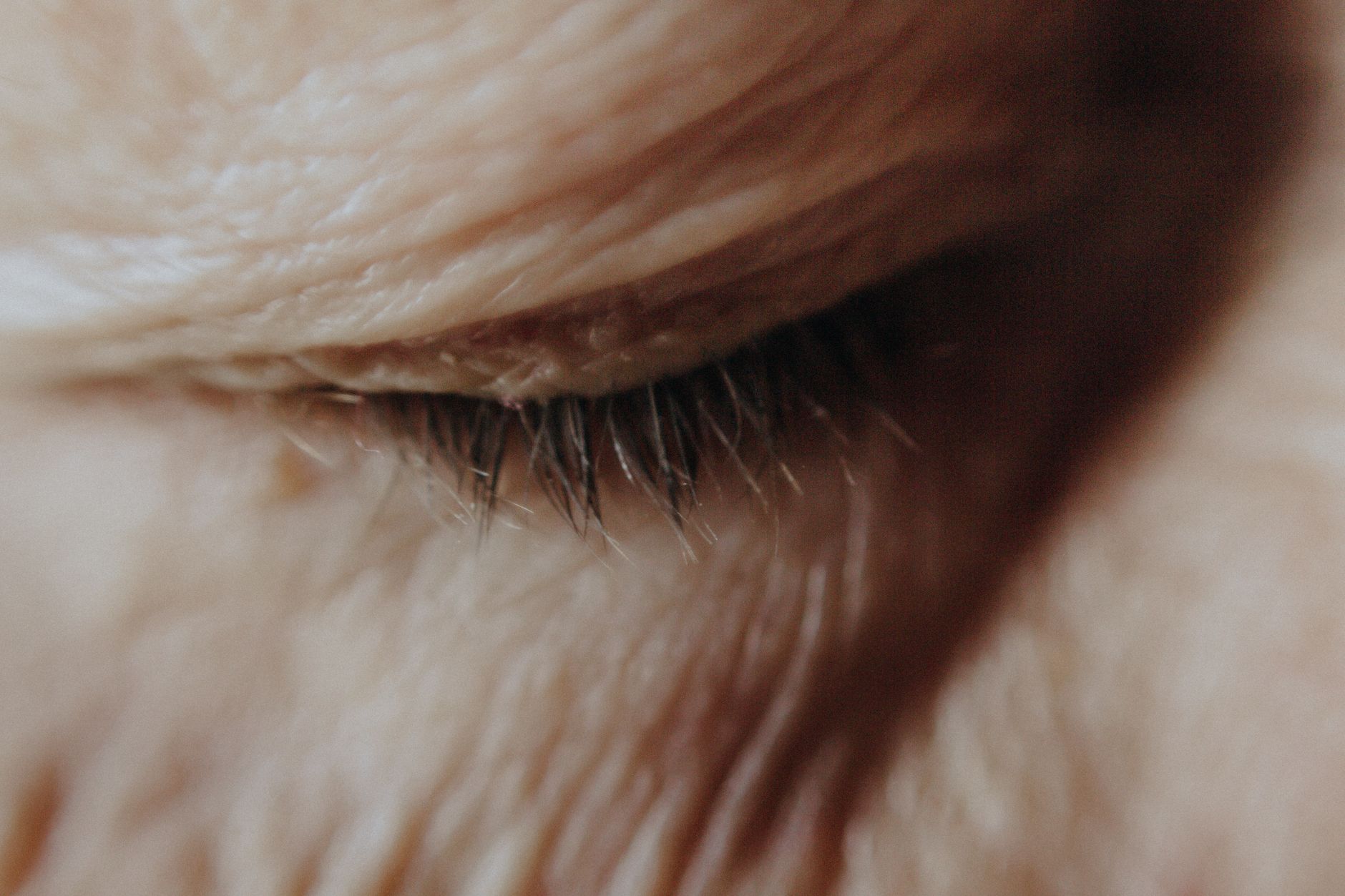 A warm compress placed over closed eyes on a soft white towel, demonstrating a non‑medicinal remedy for pink eye during pregnancy