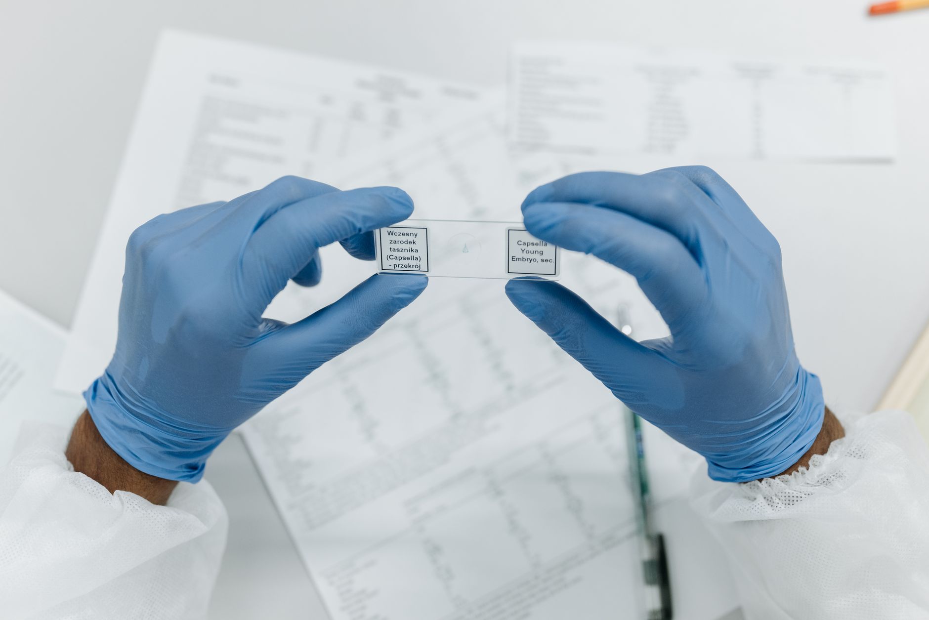 Laboratory technician examining a blood sample under a microscope, showing a positive Rh antibody screen on a computer monitor