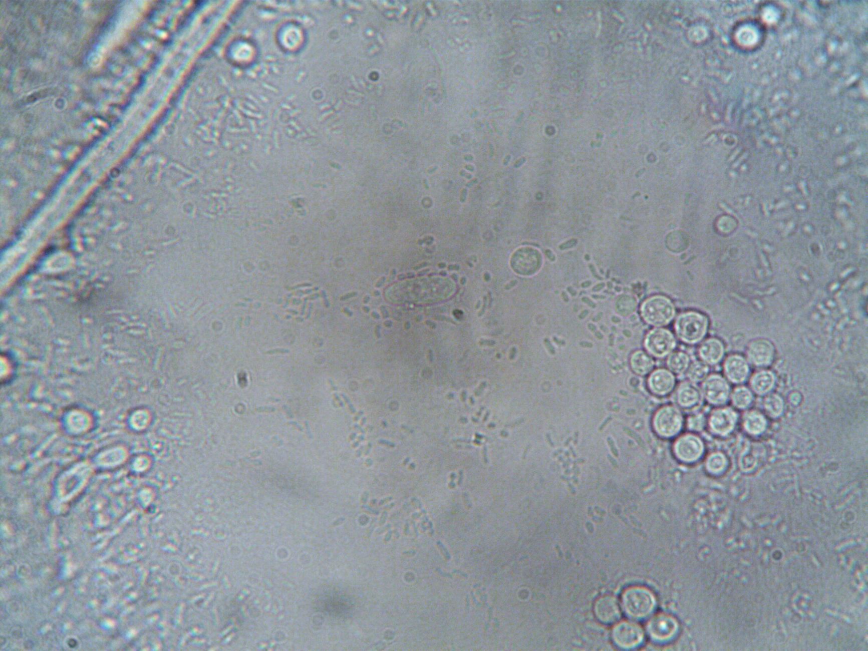 Microscope view of sperm