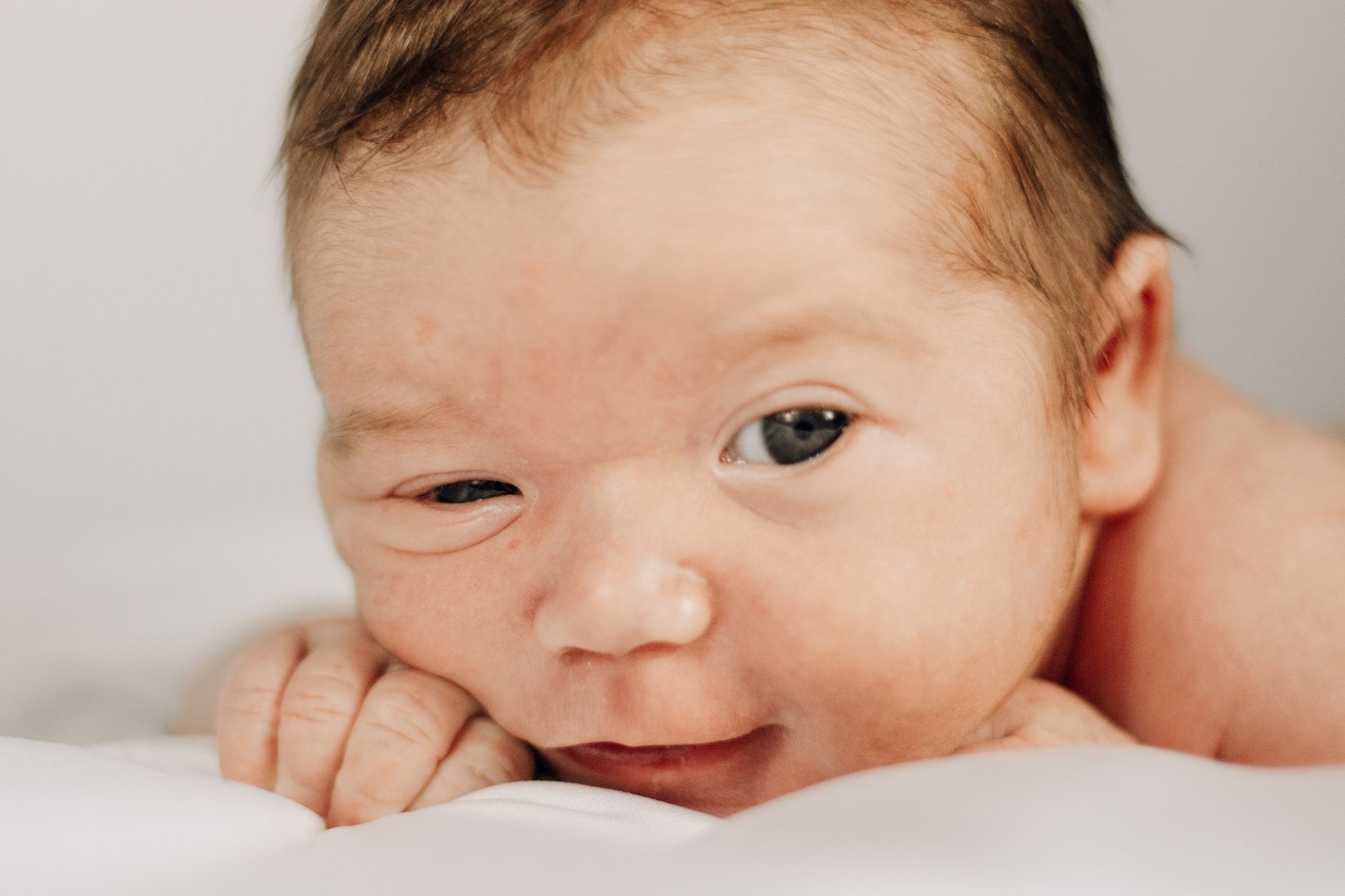 Torticollis in Baby Treatment: A Complete 2026 Guide