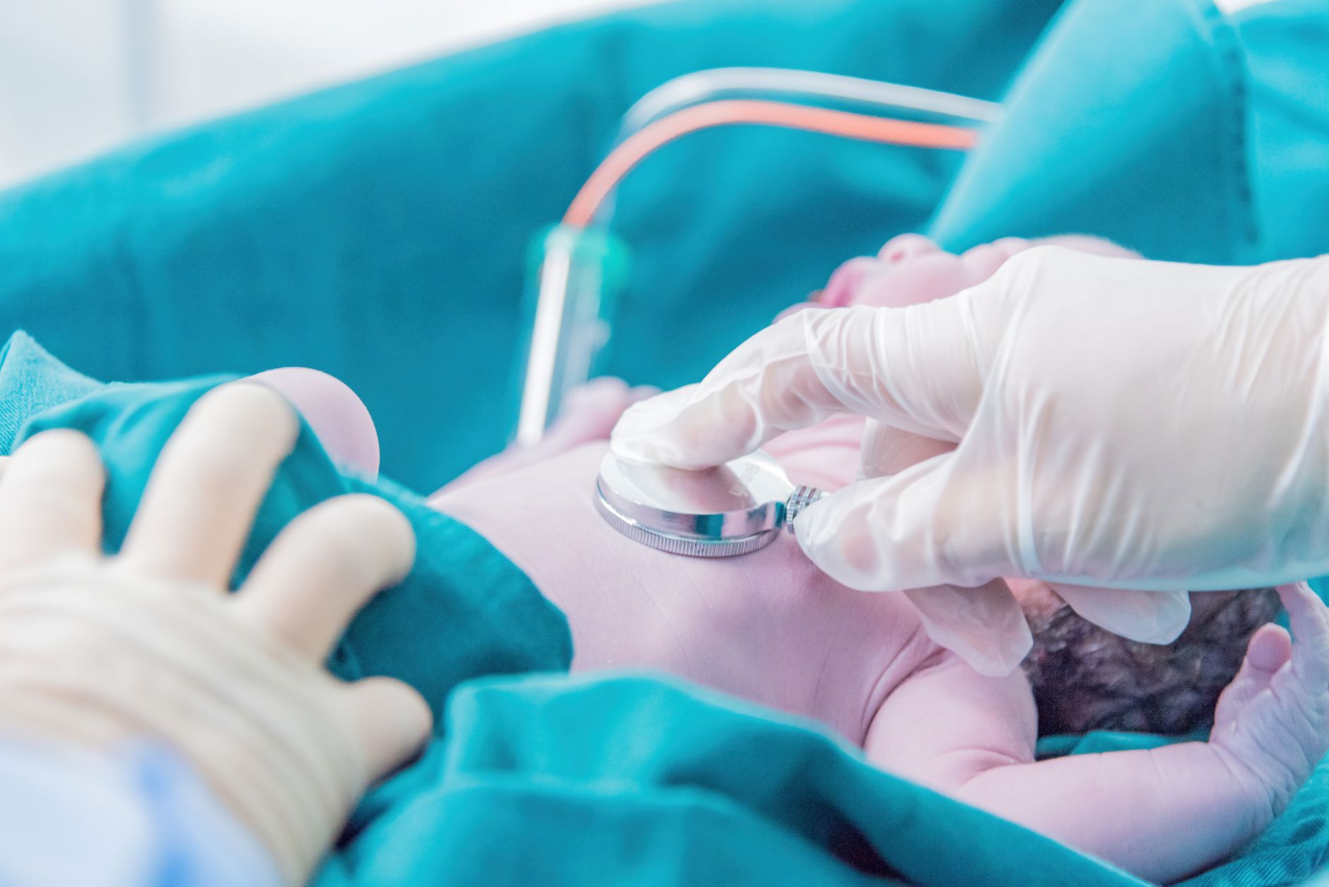 Newborn eye exam for congenital toxoplasmosis