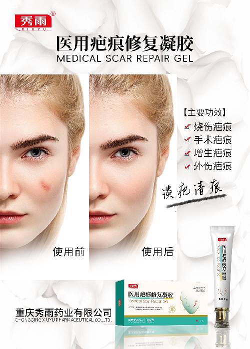 用于辅助改善皮肤病理性疤痕，辅助预防皮肤病理性疤痕的形成，不用于未愈合的伤口