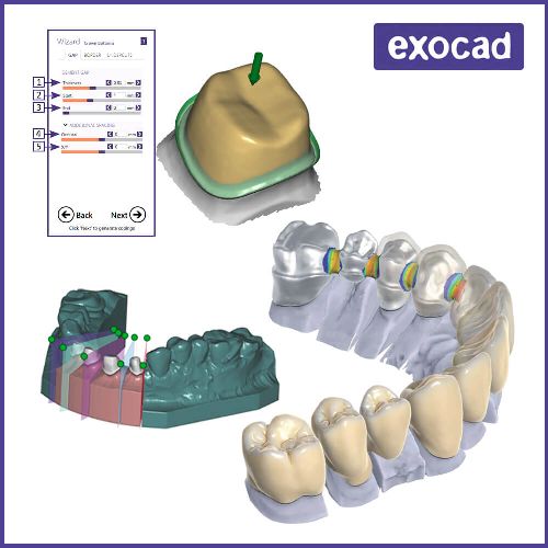 Exocad 3.2 y genkey Exoplan 3.0 Partial CAD 3.1 y