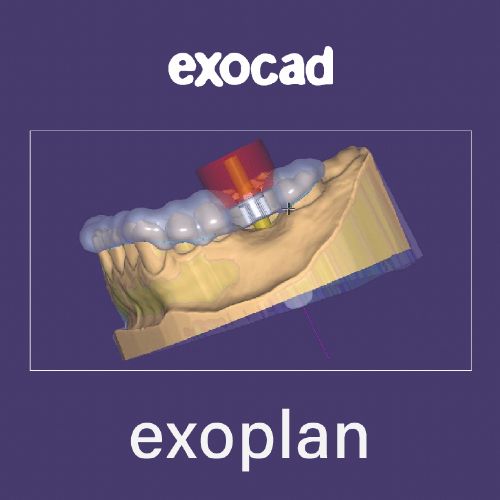 Exocad 3.2 y genkey Exoplan 3.0 Partial CAD 3.1 y