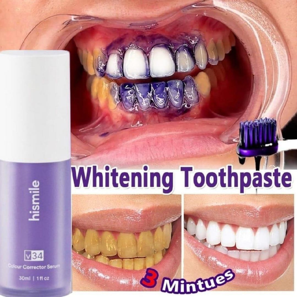 ✨ Get a Brighter, Whiter Smile in Just a Few
