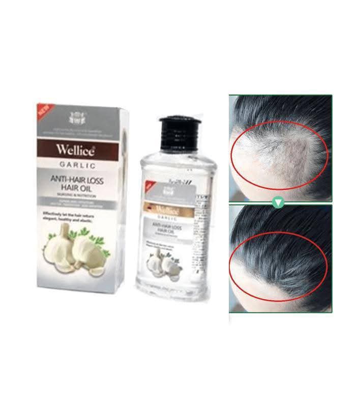 Free Home Delivery =• Material: Oil Texture: Smooth • Hair