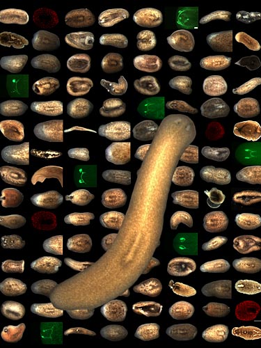 Lost Limb? Worm May Hold Answers