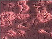 Brain cells are matured in lab 