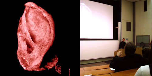 Oron Catts, talk about tissue engineering and art