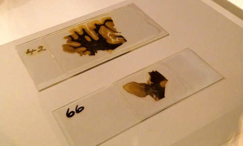Perspective Tour of Brains: The Mind as Matter with Nina Sellars 