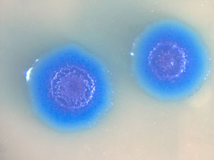 Colonies of the transformed Mycoplasma mycoides bacterium. Image Credit: J. Craig Venter Institute Colonies of the transformed Mycoplasma mycoides bacterium. Image Credit: J. Craig Venter Institute