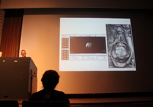 Subtle Technologies: Using MRI and drawing as maps to heal my frozen shoulder