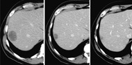 Building a Better Tumor Killer