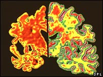 Alzheimer mice memories restored 