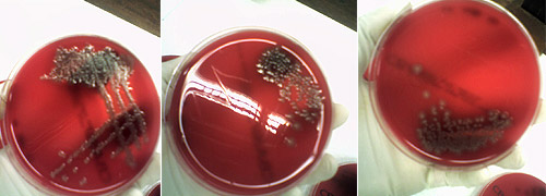 Minimum Bactericidal Concentration (MBC) experiment, © c-lab 2006