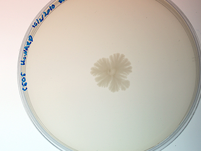 Variation in media changes bacteria’s motility. In a soft media (a mixture between solid and solute) bacteria can quickl