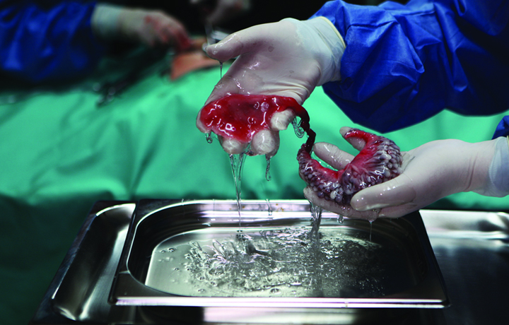 Circumventive Organs (2013), Agatha Haines 
