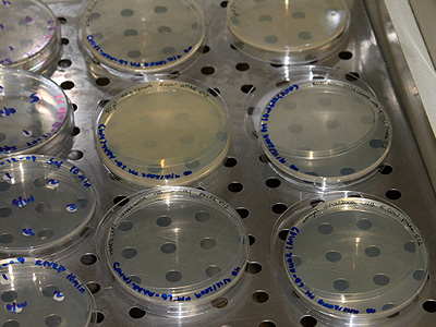 Excess fluid can cause E.coli to swim and spread in unwanted ways. A few minutes in the incubator dries any excess &copy