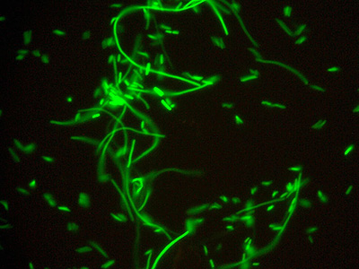 GFP E.Coli under the microscope. The long threads are bacteria stuck like sausages whilst dividing. Intertangled by prot