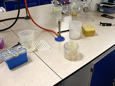 Antibiotics are used to select only transformed bacteria. When transformed these particular bacteria become resistant to