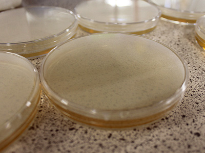 Sterile techniques are instrumental when pouring plates as contamination often comes from airbourne spores. A perfect po
