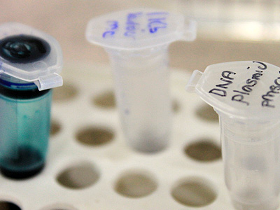 The buffer, the ladder and the sample. The sample used is a murine stemcell virus, a small vector that affect mice. The 