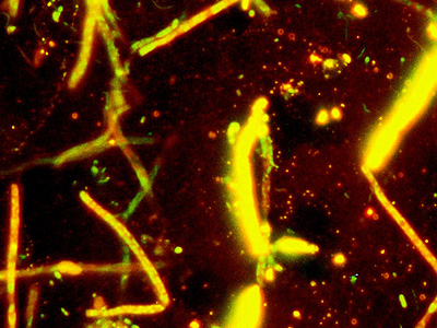 Another type of bacteria shared with a research colleague. This is an ocean based bacteria that produces wonderful spira