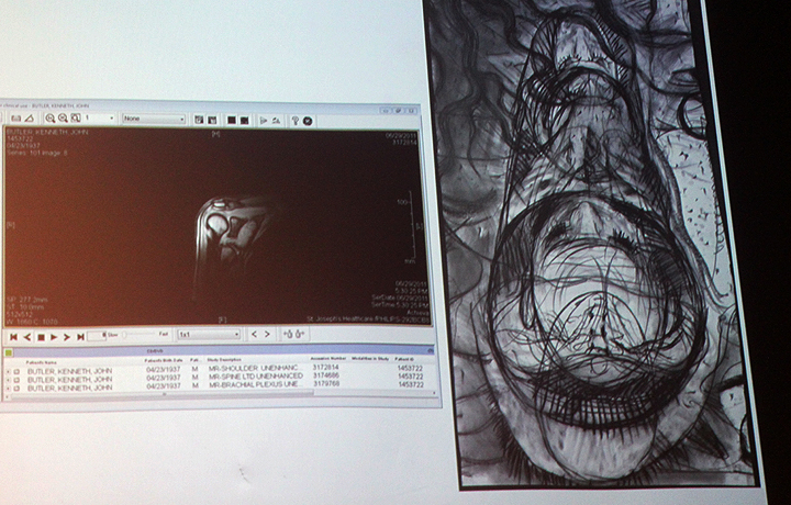 Jack Butler's presentation: Using MRI and drawing as maps to heal my frozen shoulder