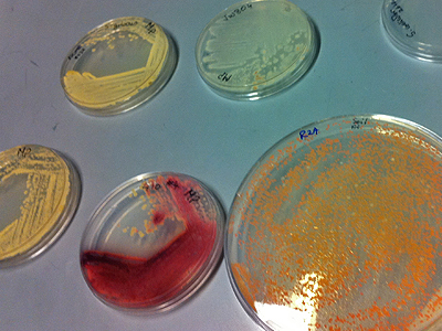 Bacterial dishes, Synthesis, UCL, London, UK, 2011.