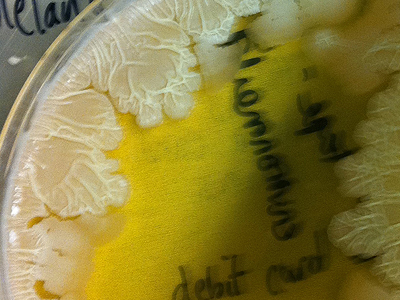 Bacterial growth in dishes, Synthesis, UCL, London, UK, 2011.