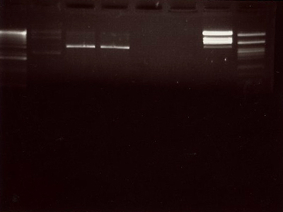 Image of plasmid restriction digests run on agarose gel, Synthesis, UCL, London, UK, 2011.