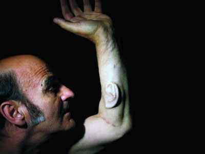 Stelarc, Extra Ear, Unsafe Distance, Enter3, Prague, 2007