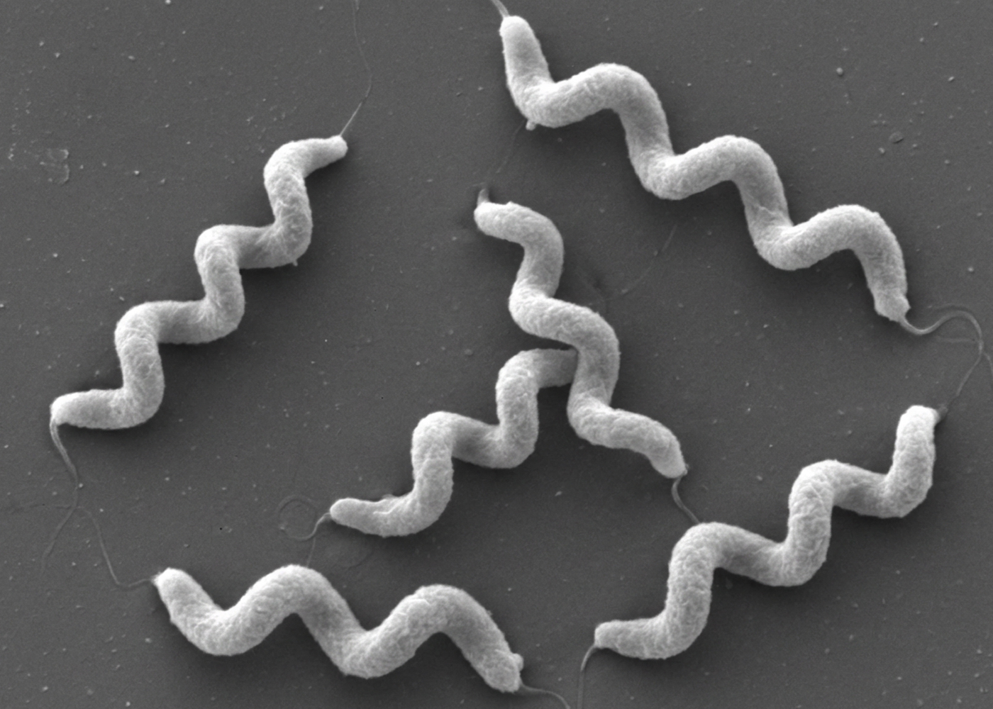 Magnetospirillum gryphiswaldense under scanning electron microscope shows their distinct spiral body shape.